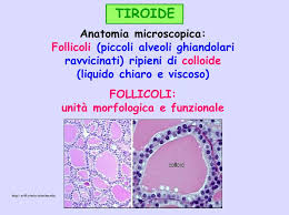 Titoide